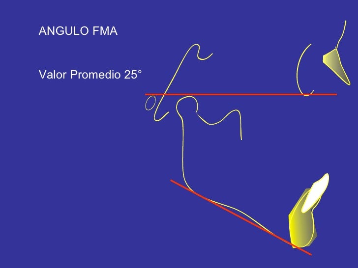 cefalometria de tweed